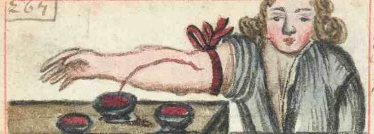 bloodletting-min